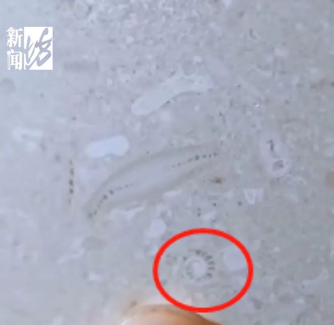 嘉定“小孩哥”儿科就诊发现化石↗很多人还真忽略了……
